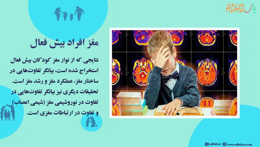 تفاوت های کلیدی مغز بچه های بیش فعال