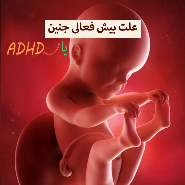 علت بیش فعالی جنین و تکان خوردن زیاد جنین در چیست؟
