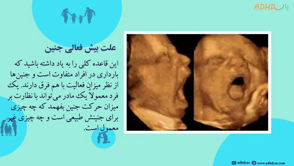علت بیشفعالی جنین: از دیابت تا آلودگی هوا! چه چیزی واقعیت دارد؟