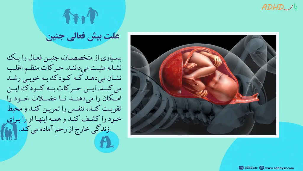 علت بیشفعالی جنین: از دیابت تا آلودگی هوا! چه چیزی واقعیت دارد؟