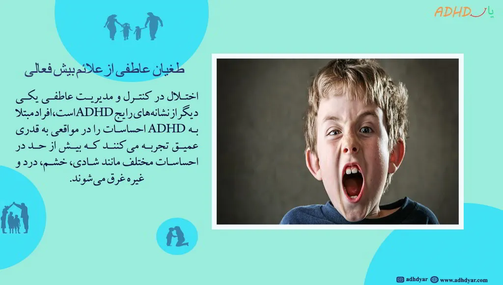 طغیان عاطفی کودک بیش فعال