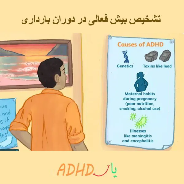 تشخیص بیش فعالی در دوران بارداری