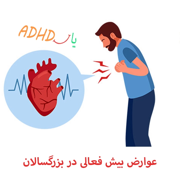 عوارض بیش فعالی در بزرگسالان