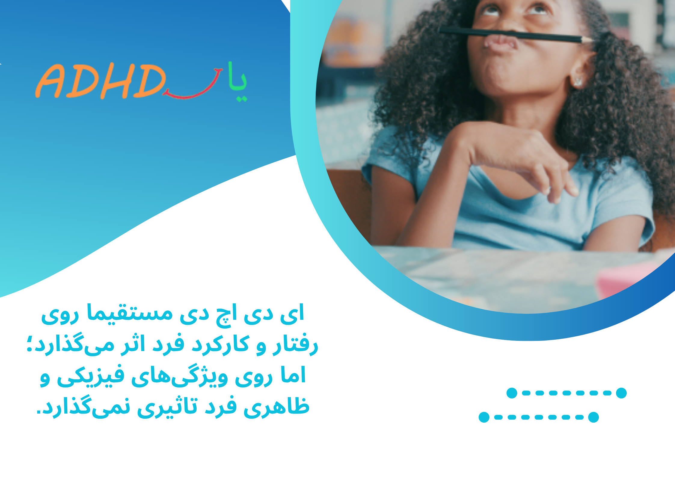 ظاهر کودک بیش فعال