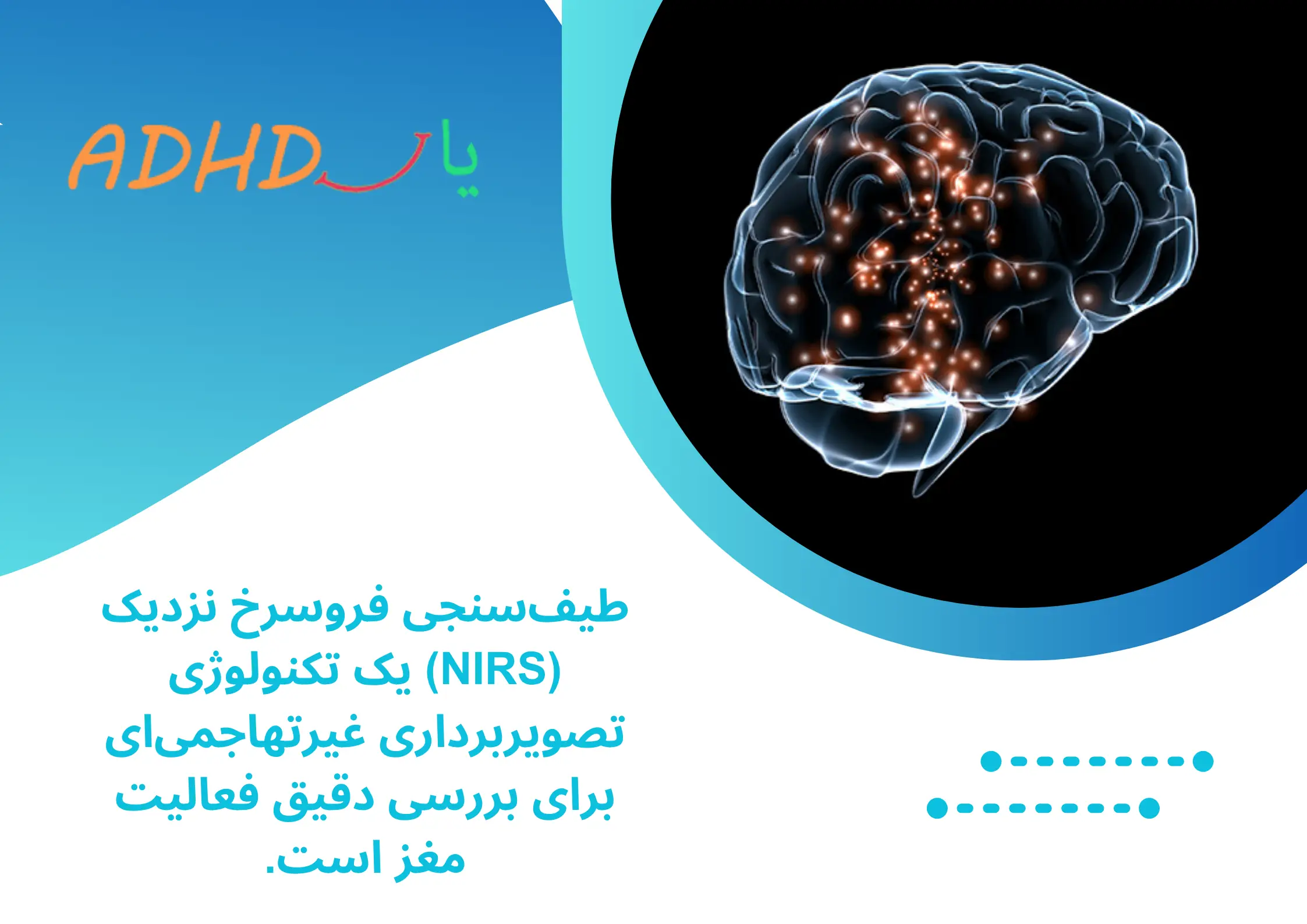 طیف‌سنجی فروسرخ نزدیک (NIRS)