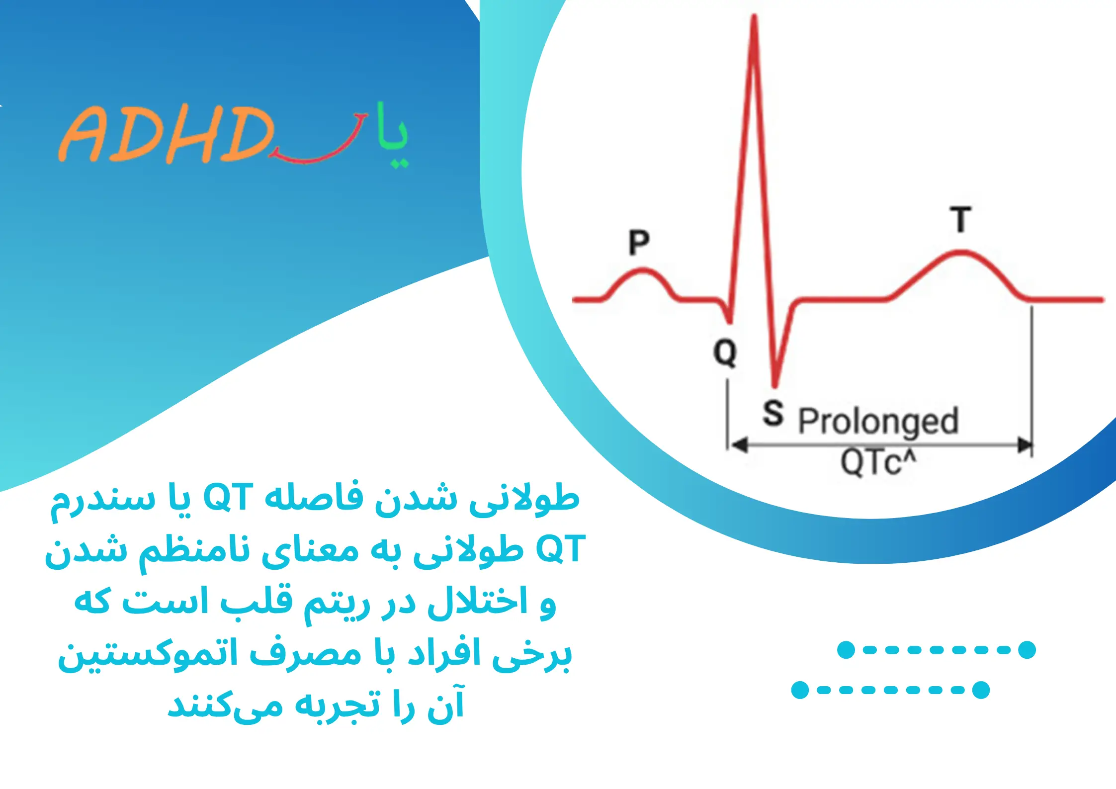 عوارض قلبی و متابولیکی اتموكستين